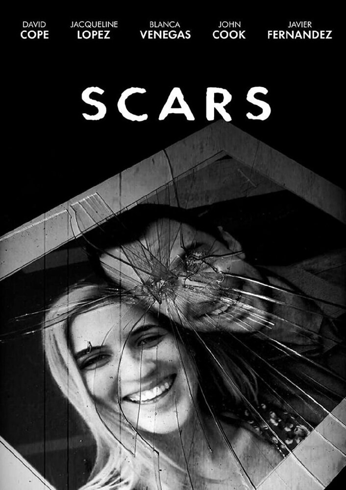Scars